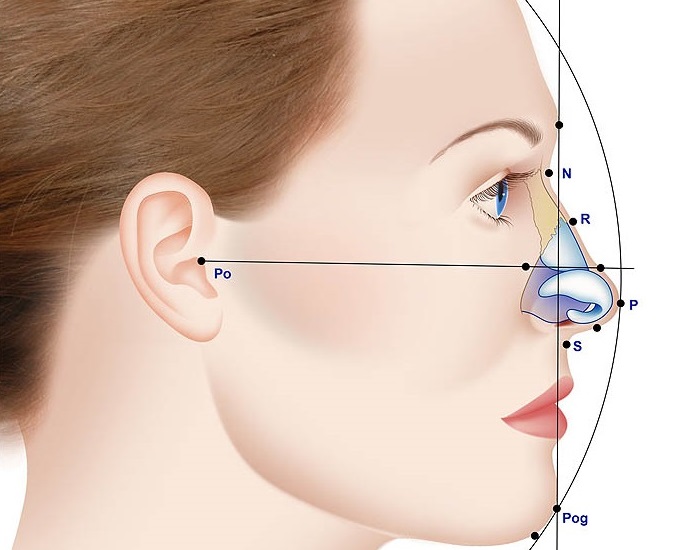 como-e-feita-a-rinoplastia-cirurgia-do-nariz