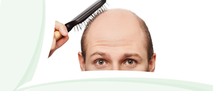 Queda de cabelo e seus tratamentos