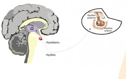 Adenoma de hipófise costuma ser um tumor benigno