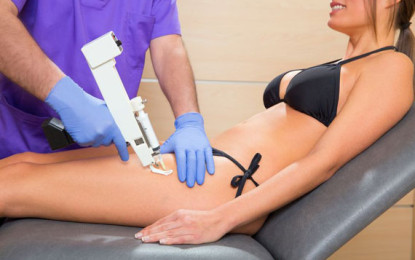 Mesoterapia no combate a celulite e gordura localizada com mesoterapia