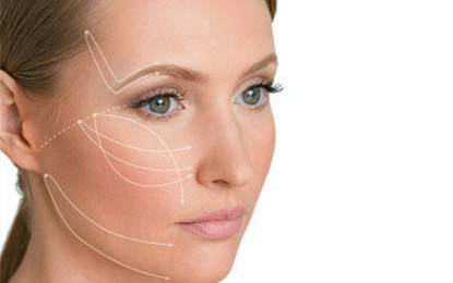 Fio Silhouette, lifting facial sem cirurgia contra flacidez e rugas