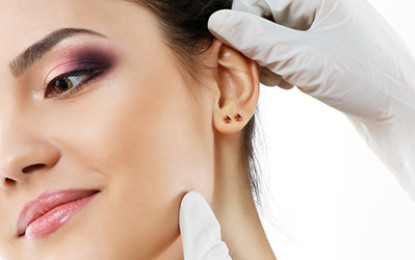 Otoplastia é alternativa para correção de orelhas