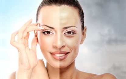 Conheça o peeling de fenol, que pode rejuvenescer a pessoa em 20 anos