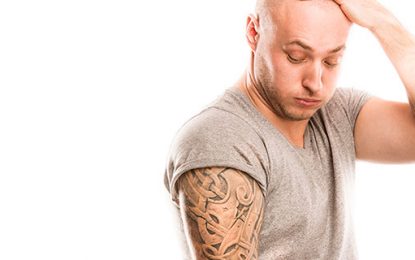 Tecnologia 4G para remoção de tatuagem