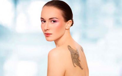 Fototermólise seletiva para remoção de tatuagem