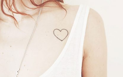 Rede de franquias para remoção de tatuagem na capital