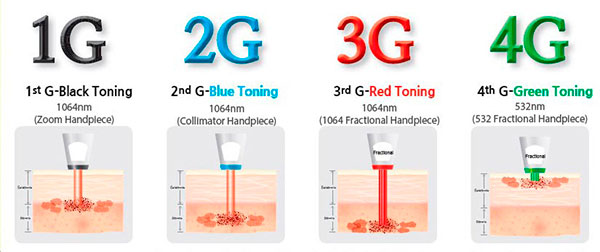 diagrama da tecnologia 4G na pele para remoção de tatuagem