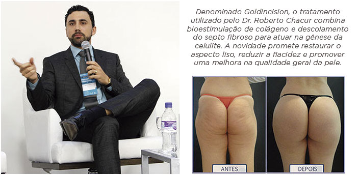 dr roberto chacur sentado com microfone na mão e foto antes e depois do tratamento para celulite goldincision