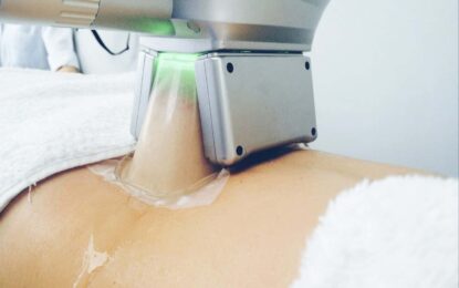 O que é criolipólise para gordura localizada?